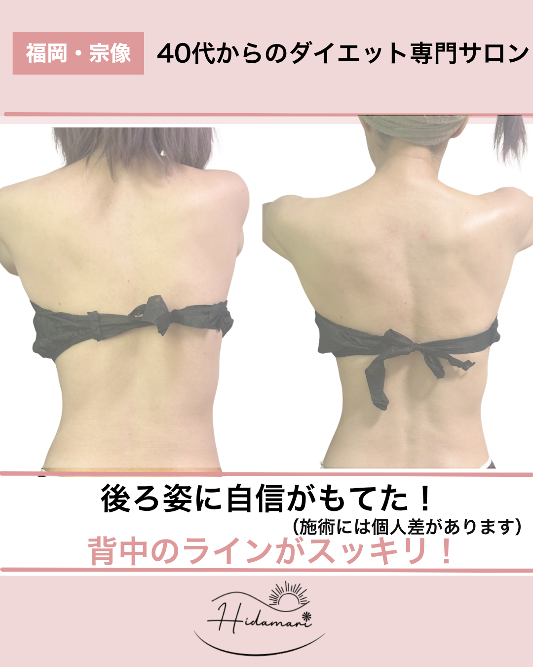 宗像で40代からの健康的ダイエット 耳つぼ×リンパで理想の体へ